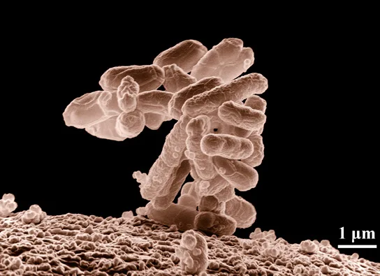 A false-color scanning electron micrograph showing a cluster of dozens of rod-shaped E. coli bacteria clumped together on a granular surface, with a 1-micron scale bar for size.