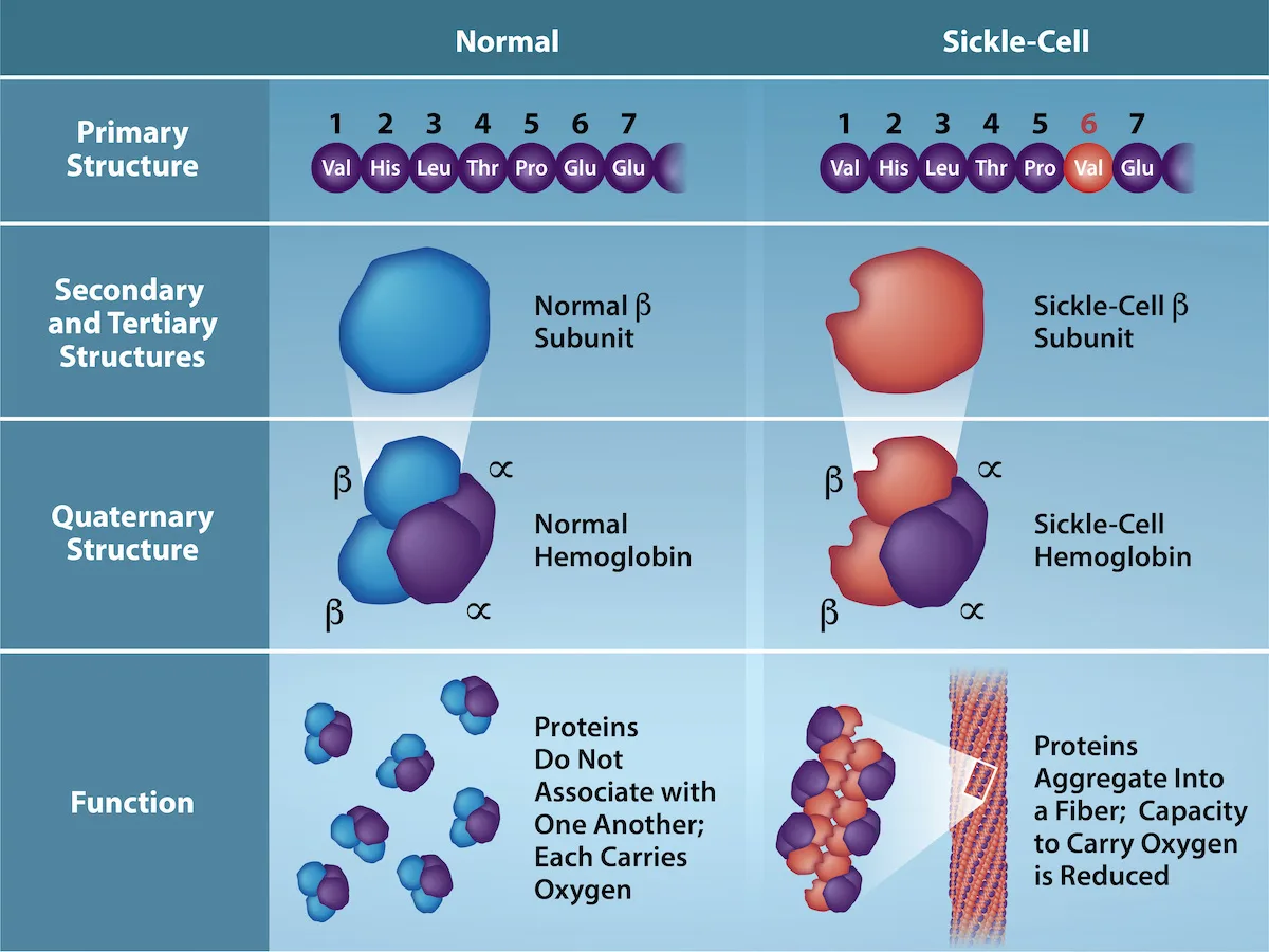 Several representations of hemoglobin proteins under normal and sickle-cell conditions. In primary structure, the sixth amino acid is replaced by valine. In secondary and tertiary structures, the sickle-cell molecule is misshapen. As a result, normal hemoglobins do not associate with each other and each can carry oxygen, but sickle-cell proteins aggregate into a fiber and their oxygen-carrying capacity is reduced.