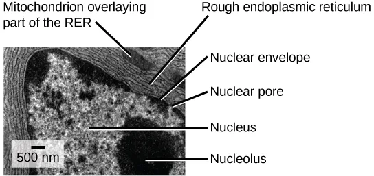 A grayscale transmission electron micrograph of a cell's nucleus and surrounding cytoplasm, with six labeled parts and a scale bar.
