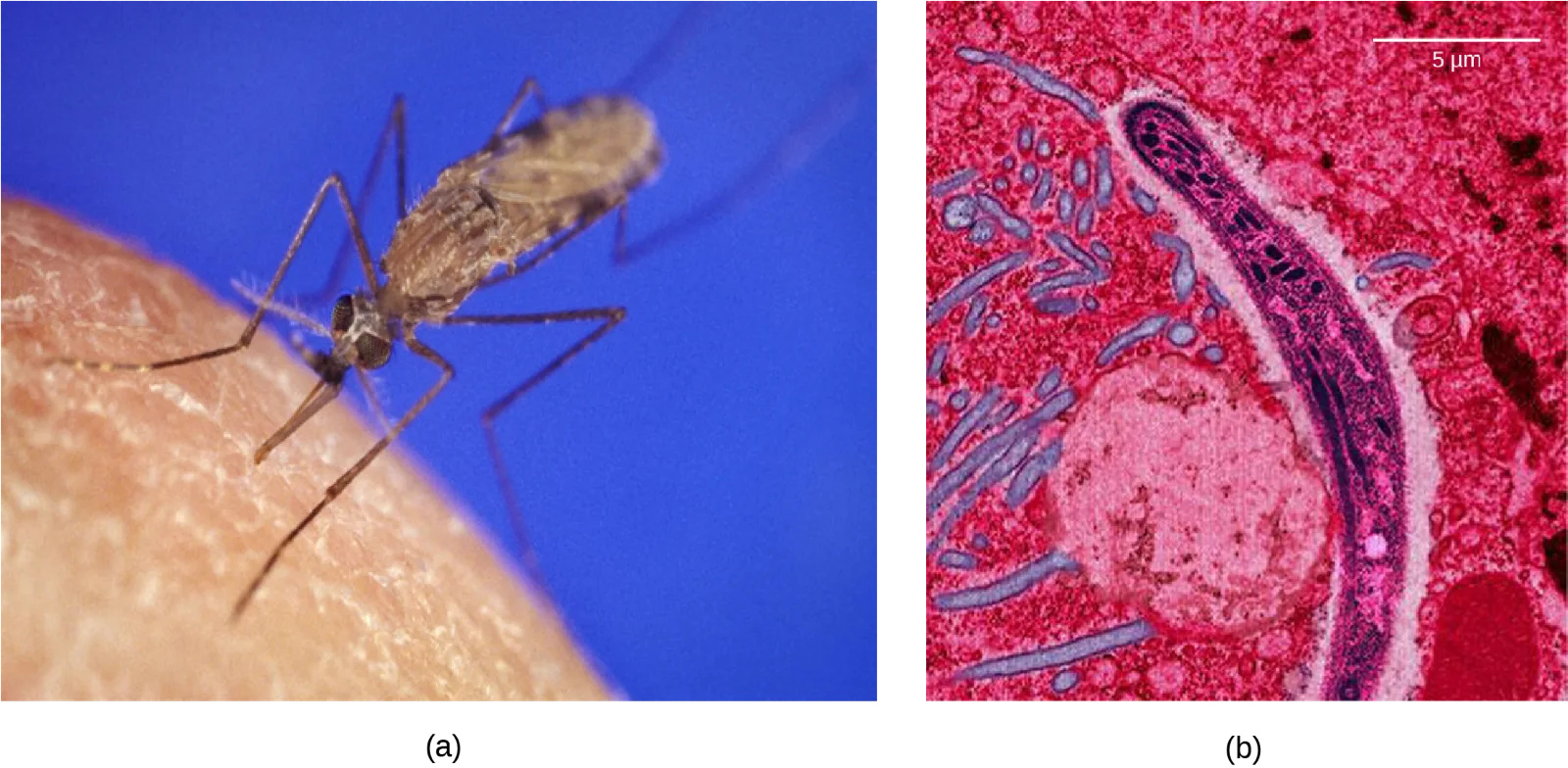 Two side-by-side photos. Panel (a) is a color photograph of an Anopheles gambiae mosquito perched on skin. Panel (b) is a false-color transmission electron micrograph of a sickle-shaped Plasmodium falciparum parasite, shown in pink and purple tones.