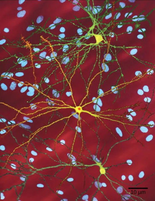 A fluorescence micrograph on a dark red background showing several yellow-green neurons with branching processes among many small blue-stained cell nuclei; the central neuron has an orange nuclear inclusion.