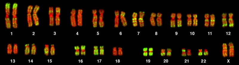 A karyotype image: two rows of paired, banded chromosome images running from largest to smallest, arranged in numbered columns 1 through 22 with a final column labeled X.