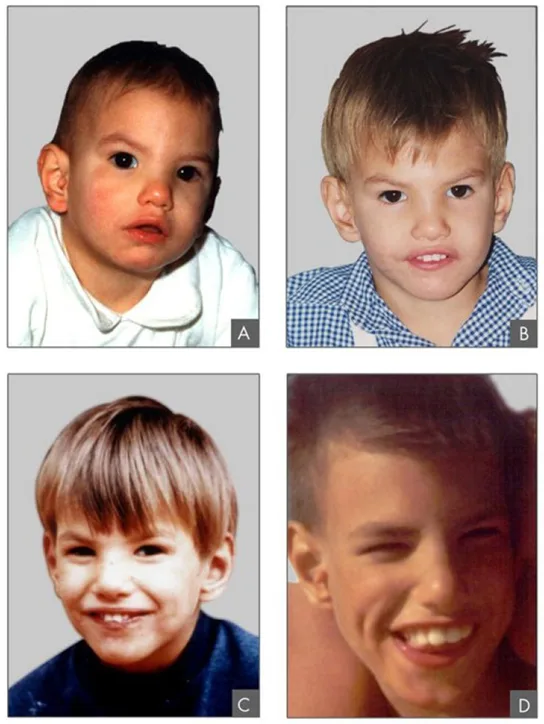 Four individual head-and-shoulders photographs of the same boy, labeled A through D by age, showing a progression from infancy to boyhood: a dark-haired infant in panel A, a young boy with tousled fair hair in panel B, a smiling boy with combed, fringed fair hair in panel C, and an older boy with short hair and a broad smile in panel D.