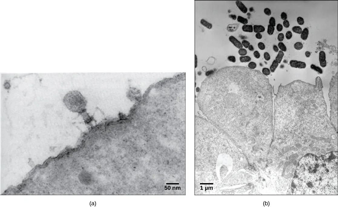 (a) A transmission electron micrograph shows a small virus with a hexagonal head standing on thin, bent tail fibers, on the surface of a bacterial cell so large that only a small curved portion of it is visible, with a 50 nm scale bar. (b) A transmission electron micrograph shows a cluster of small oval and rod-shaped E. coli bacterial cells above two much larger colon cells, each bacterium about the size of an organelle within the colon cells, with a 1 µm scale bar.