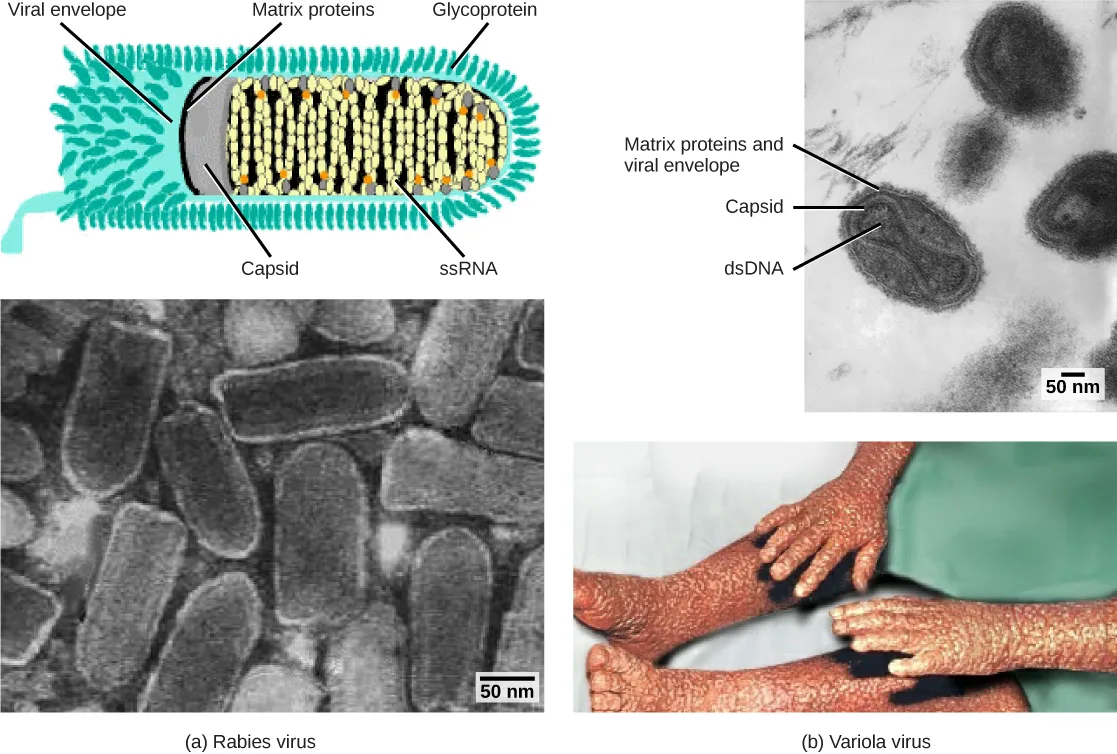 Four panels labeled (a) Rabies virus and (b) Variola virus. Top-left: a labeled diagram of a bullet-shaped rabies virion — coiled ssRNA inside a capsid, surrounded by a matrix-protein-lined envelope studded with glycoprotein spikes. Bottom-left: an electron micrograph of a cluster of bullet-shaped rabies virus particles. Top-right: an electron micrograph of three oval variola virus particles with capsid and matrix-protein/envelope layers labeled. Bottom-right: a photo of irregular, bumpy pox lesions covering a person's arms and legs.
