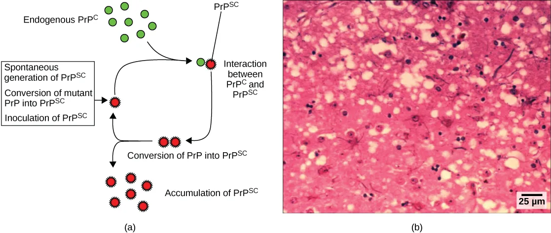 Two-panel figure. Panel (a) is a labeled flow diagram showing normal PrPc converting to the infectious PrPsc form and PrPsc accumulating through a cyclic pathway. Panel (b) is a light micrograph of prion-infected brain tissue showing a spongy, vacuolated texture.