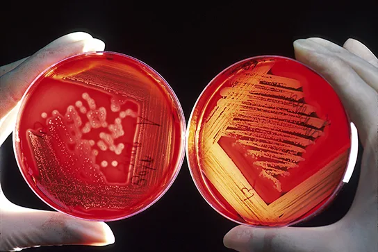 A photo of two round blood agar plates held in gloved hands, side by side, each streaked with bacterial colonies. The left plate shows large white colonies against opaque red agar; the right plate shows tiny colonies with the surrounding red agar turned clear.
