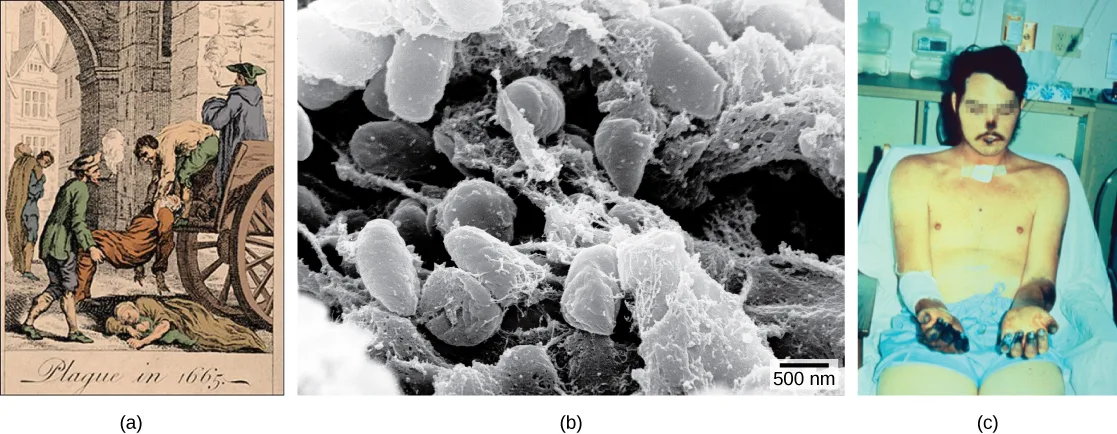 Three panels. (a) A hand-colored engraving titled 'Plague in 1665' showing two men loading a dead body onto a horse-drawn cart while another body lies in the street. (b) A black-and-white scanning electron micrograph of numerous elongated, rod-shaped bacteria, with a 500 nm scale bar. (c) A photograph of a patient's bare torso and hands, with the fingers, palms, and forearms discolored black from gangrene.