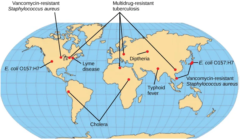 A world map with labeled points marking where bacterial diseases are emerging or re-emerging. Multidrug-resistant tuberculosis is marked in North America, Europe, north Africa, and Asia. Vancomycin-resistant Staphylococcus aureus and E. coli O157:H7 are marked in North America and East Asia. Lyme disease is marked in North America. Cholera is marked in Africa and South America. Diphtheria and typhoid fever are marked in Asia.