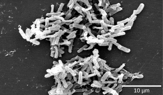 A scanning electron micrograph shows small clusters of white, rod-shaped bacteria against a dark background, with a 10 µm scale bar.