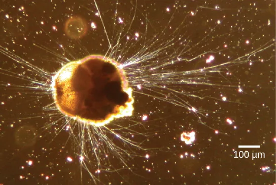 A phase-contrast light micrograph of a semi-round, orange-brown Rhizaria cell with numerous long, thin, hair-like pseudopodia radiating outward, a 100 µm scale bar at lower right.