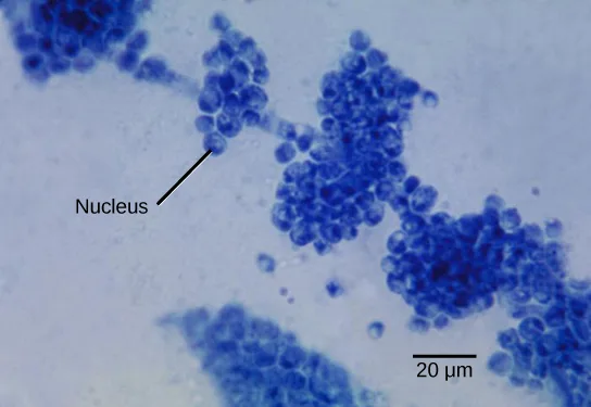 Micrograph of clumps of small round blue-stained yeast cells against a light blue background, with a line and label pointing to the nucleus inside one cell near the center, and a 20 µm scale bar at lower right.