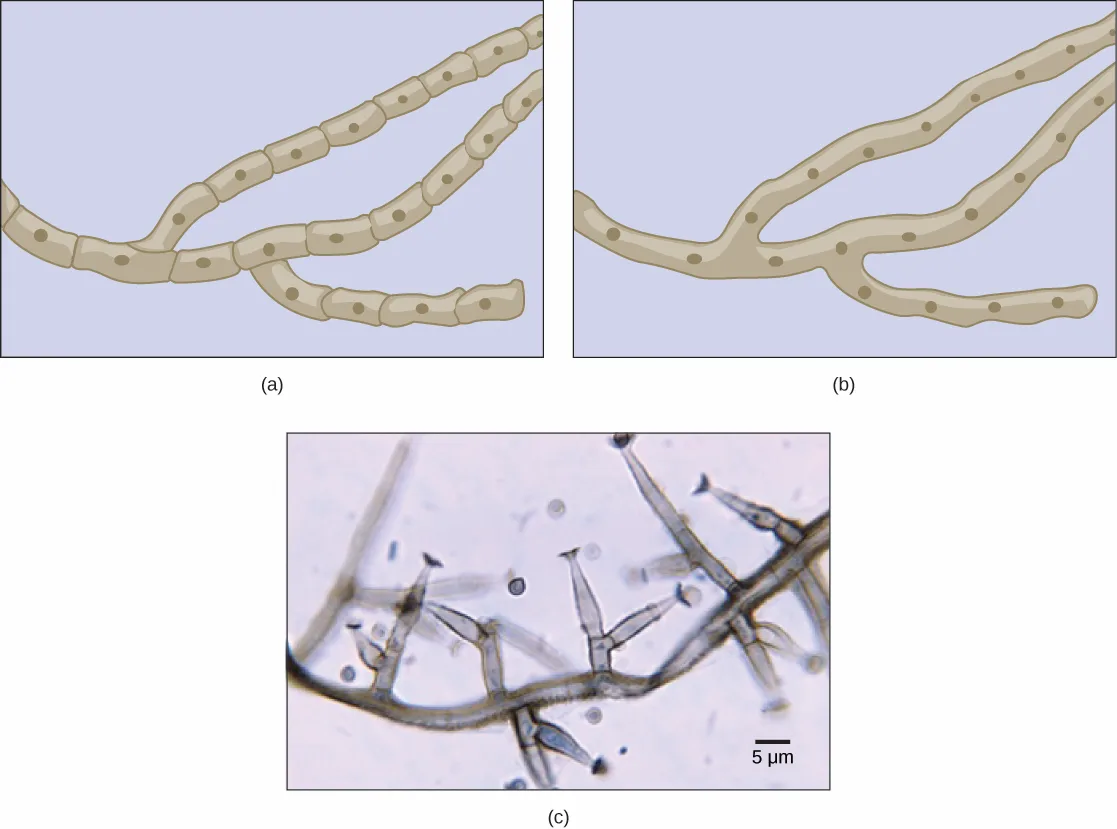 Three-panel figure: (a) a drawing of septated hyphae, each rectangular cell holding its own dark dot (nucleus) and joined end to end in two branching filaments; (b) a drawing of coenocytic hyphae, similar branching filaments but undivided by any cross-walls, with several dots (nuclei) scattered freely inside the shared cytoplasm; (c) a light micrograph of septated hyphae from Phialophora richardsiae, showing branching threadlike filaments with visible cross-walls, alongside a 5 µm scale bar.