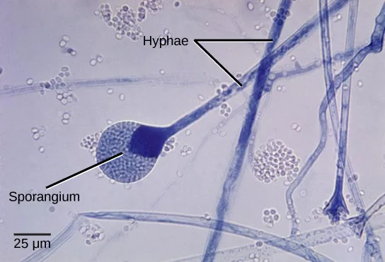 Micrograph of thread-like blue-stained hyphae, two labeled 'Hyphae,' meeting at a round sporangium labeled 'Sporangium' that is dark blue at its neck and grainy white and blue elsewhere, with scattered small white oval spores already released nearby and a 25 µm scale bar at lower left.