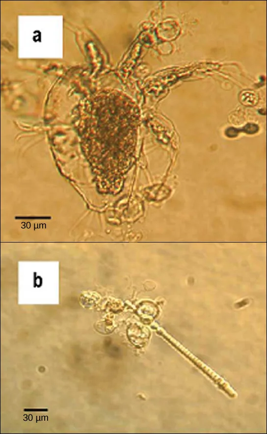 Micrograph A shows an arthropod, a teardrop-shaped transparent organism about 90 microns across and 120 microns long, with tentacle-like appendages jutting from its front, wide end and clusters of cilia-like appendages from its sides and back; transparent oval organisms about 20 microns across cling to it. Micrograph B shows similar transparent oval organisms clinging to rod-shaped algae about 5 microns across and 200 microns long.