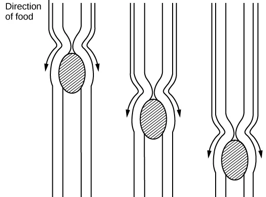 A schematic line drawing of three side-by-side esophagus segments, each a pair of parallel walls narrowing around a hatched oval mass, with arrows showing the constriction moving down the tube behind the mass in each successive segment.