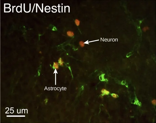 A fluorescence micrograph labeled BrdU/Nestin in the upper left, showing scattered small orange and green punctate cells against a black background. A white arrow labeled Neuron points to an orange cell near the upper right, and a second arrow labeled Astrocyte points to a cell showing both orange and green near the center. A scale bar reading 25 µm sits at the lower left.