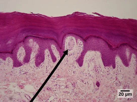 A photomicrograph of skin in cross-section, showing a deeply staining, ridged epidermis above a lighter-staining dermis; an arrow points to an oval Meissner corpuscle sitting between two of the epidermis's finger-like ridges.
