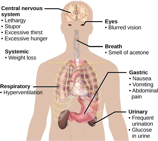 A body outline with seven labels, six of them on leader lines, showing where the symptoms of diabetes appear: the brain, eyes, breath, general body weight, the respiratory system, the stomach, and the urinary system.