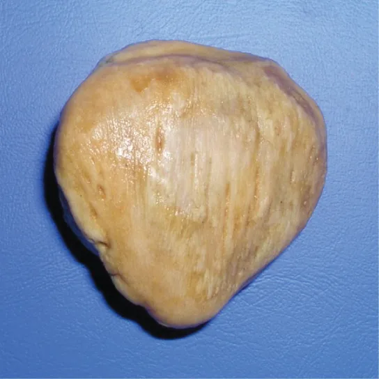 A close-up photo of a smooth, rounded, teardrop-shaped bone lying flat, lit against a blue background.