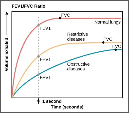 A line graph titled FEV1/FVC Ratio plots volume exhaled on the vertical axis against time in seconds on the horizontal axis. Three curves rise from the origin: a steep red curve for normal lungs reaches the highest plateau quickly, a shallower orange curve for restrictive diseases reaches a lower plateau nearly as quickly, and a shallower blue curve for obstructive diseases rises slowly to the lowest plateau. A dotted vertical line marks one second, where each curve's FEV1 value is read; a dot near each curve's plateau marks its FVC value.