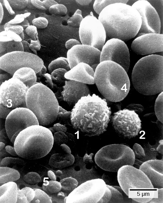Micrograph shows a blood smear. Red blood cells are disk-shaped and pinched together in the center. Monocytes, lymphocytes, and neutrophils are all ball-shaped and fuzzy. Platelets are small, flat disks.