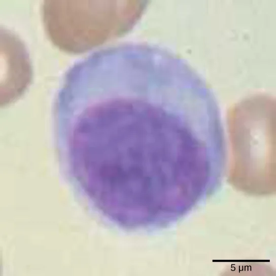 Micrograph shows a round lymphocyte with a large, darkly stained nucleus and a thin rim of pale cytoplasm, surrounded by paler red blood cells.