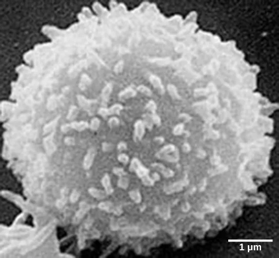 A scanning electron micrograph shows one round T lymphocyte densely covered in short, finger-like surface projections, with a 1 µm scale bar.