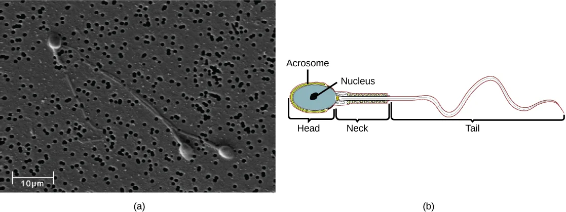 Panel (a) is a black-and-white scanning electron micrograph of three sperm cells among small dark particles, each with an oval head and a long wavy flagellum, with a scale bar reading 10 micrometers. Panel (b) is a diagram of one sperm's head, neck, and tail; the head's outer yellow layer is labeled Acrosome and its blue oval interior is labeled Nucleus.