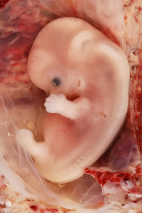 A close-up photo of a human fetus shows a large, bent head with a dark eye, an arm with visible fingers, and a small leg bud, resting against reddish tissue; the spine is visible through the back, and the rounded stomach protrudes as far as the leg bud.