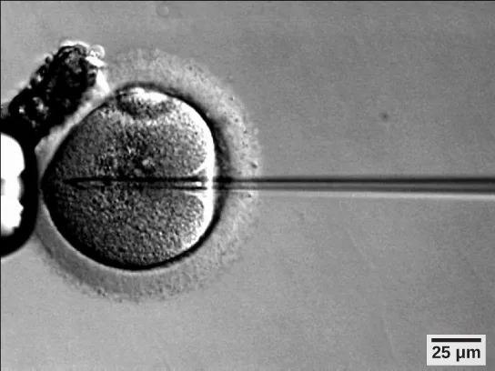 A black-and-white micrograph shows a rounded egg cell with a thin glass needle inserted into it from the right, injecting sperm; a smaller cell cluster sits at the upper left, and a 25 µm scale bar appears in the lower right corner.