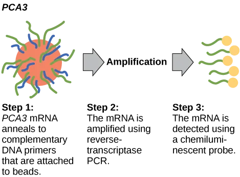 Three-step diagram. Step 1: an orange bead with blue and green strands radiating from it. Step 2: an arrow labeled Amplification. Step 3: five green strands, each tipped with a small yellow circle.