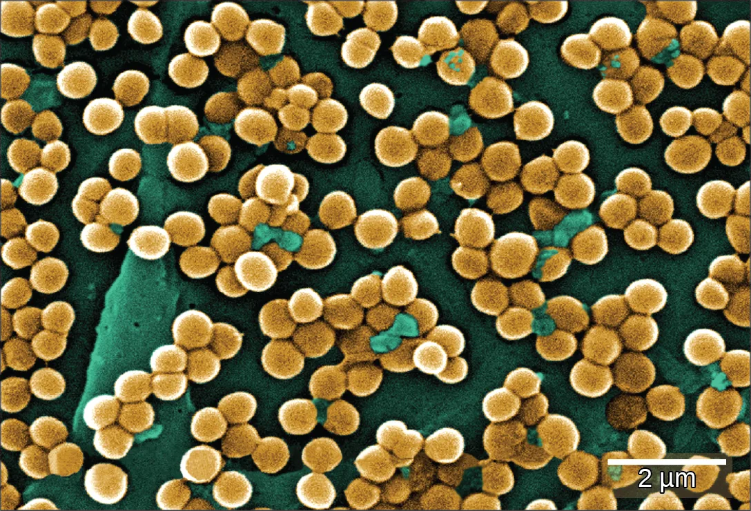Colorized scanning electron micrograph showing clusters of round, golden-colored bacteria, each about 0.4 micrometers across, clinging to a teal-colored surface, with a 2 µm scale bar.