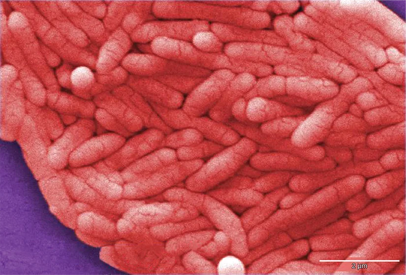Colorized scanning electron micrograph showing numerous pink, rod-shaped Salmonella enterica bacteria clustered together against a purple background, with a 2 µm scale bar.