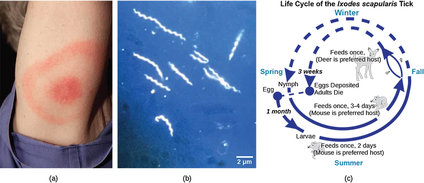 Three panels. (a) A photograph of a red, bullseye-shaped rash on a person's forearm. (b) A dark-field micrograph of several thin, corkscrew-shaped Borrelia bacteria, with a 2 µm scale bar. (c) A diagram titled 'Life Cycle of the Ixodes scapularis Tick.'