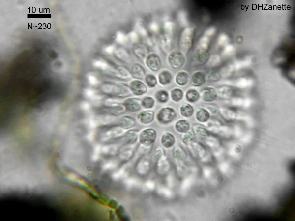 A phase-contrast micrograph of a colonial choanoflagellate: a central rounded structure with numerous smaller circular cells arranged around its surface, a 10 µm scale bar at upper left.