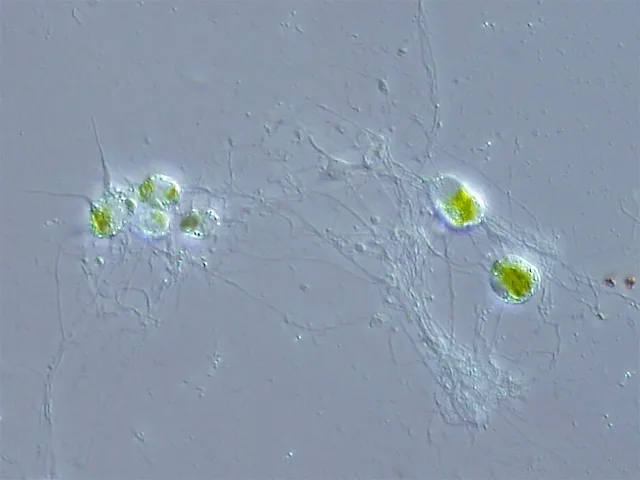 A light micrograph of a Chlorarachniophyte: several rounded green cells connected by a fine web of thread-like cytoplasmic pseudopodia.