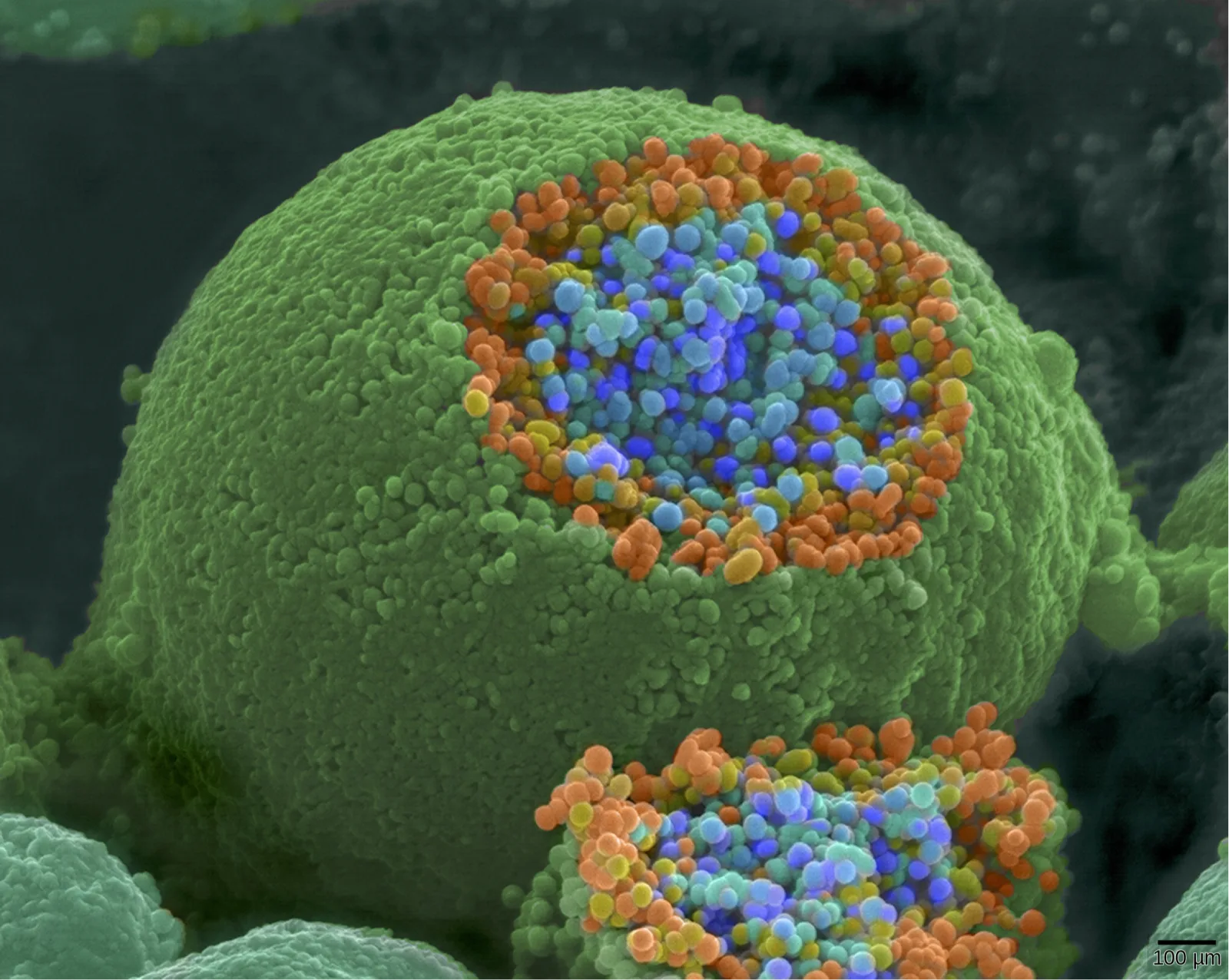 A pseudocolored scanning electron micrograph of a round, textured green axon terminal sliced open to reveal a tightly packed cluster of small blue and orange spherical vesicles inside; a smaller second terminal with a similar cluster is visible at lower right.