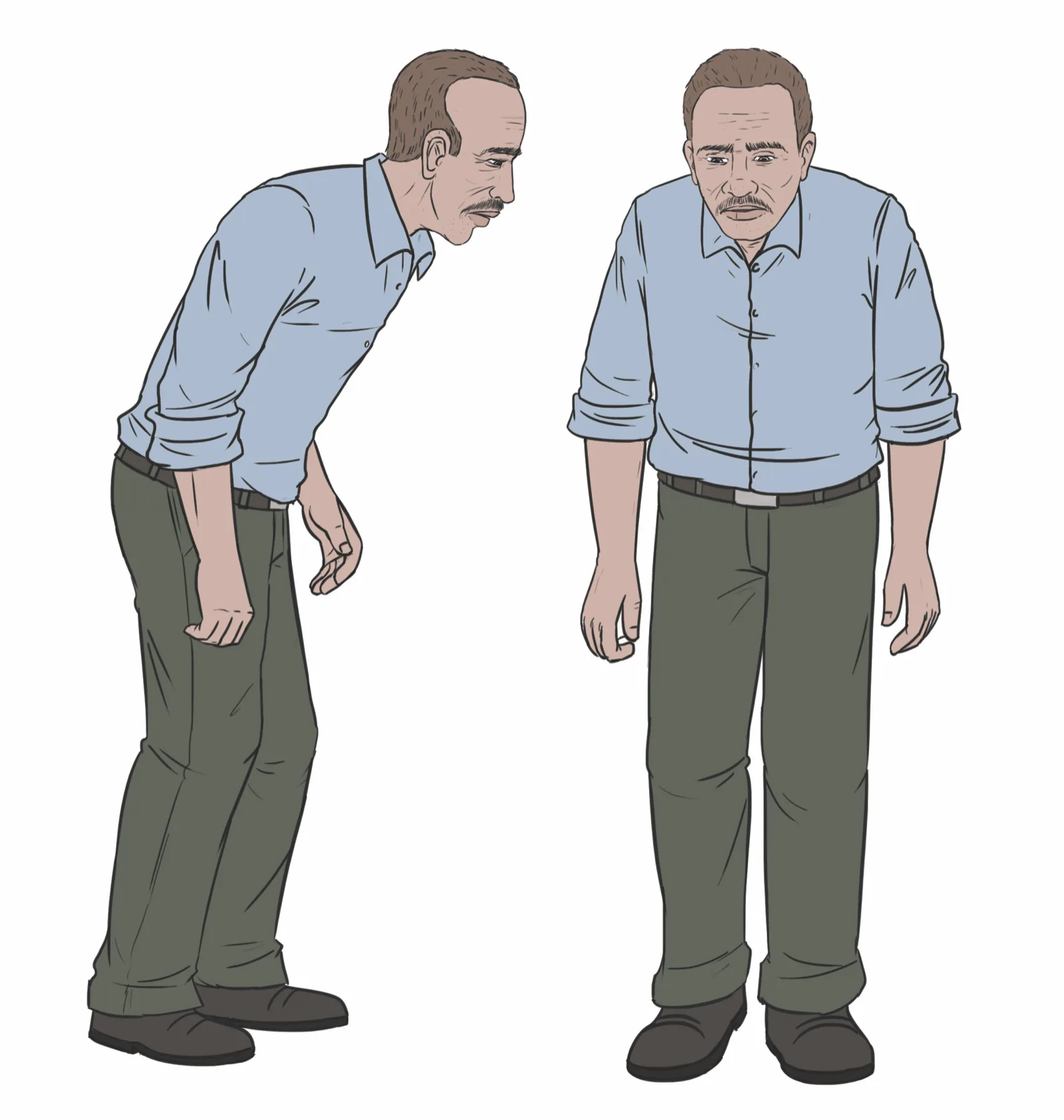 A line-drawn illustration of the same man shown twice: at left in profile, bent forward at the waist with his head down, arms held stiffly with one hand curled; at right standing upright and facing forward in the same shirt and trousers.