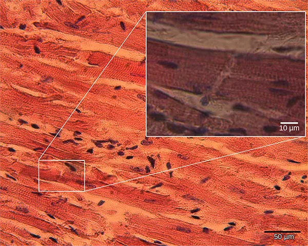 A micrograph of oblong, striated cardiac muscle cells, with an inset magnifying a smaller boxed region to show the striations and a cell-to-cell junction in more detail; scale bars mark 50 µm on the main image and 10 µm on the inset.