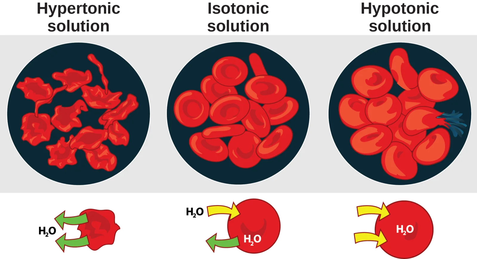 Three circles are labeled Hypertonic solution, Isotonic solution, and Hypotonic solution, each holding a cluster of red blood cells: shriveled and irregular in the hypertonic circle, normally disc-shaped in the isotonic circle, and swollen and rounded (one cell bursting) in the hypotonic circle. Below each circle, a single cell has arrows showing the direction water moves across its membrane.