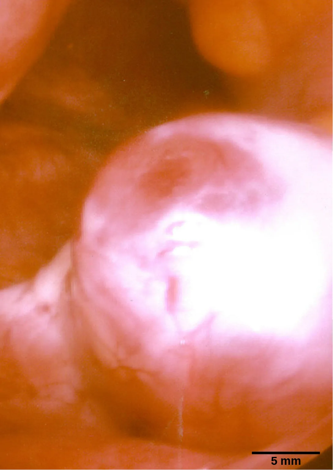 A close-up photograph of a translucent pink-and-white spherical ovarian follicle bulging from darker reddish-brown surrounding tissue, with a black scale bar reading 5 mm at the lower right.