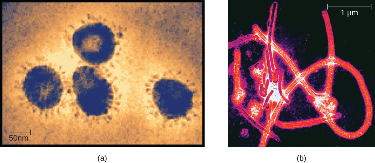 (a) A TEM micrograph showing four large circular particles with many small projections around their edges; a scale bar marks 50 nanometers. (b) A TEM micrograph showing long, tangled reddish strands forming a knot-like structure.