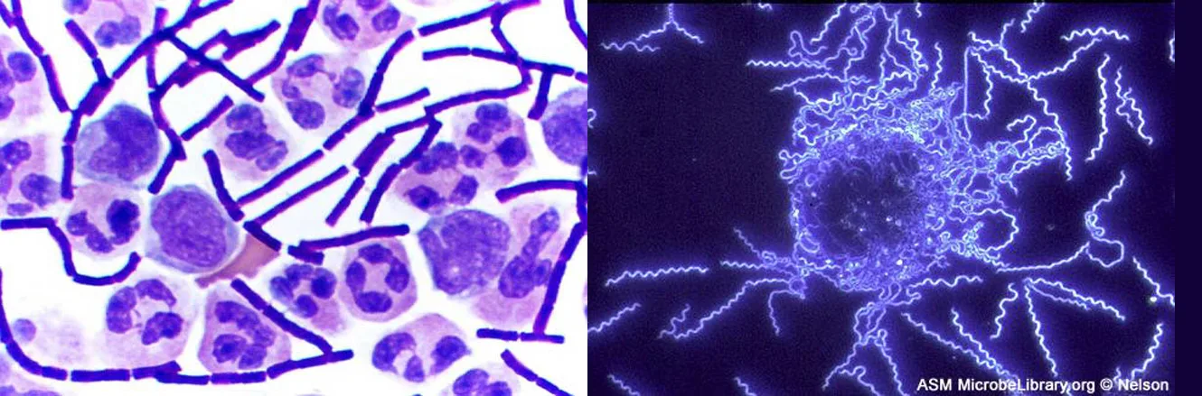 Two micrographs side by side. On the left, dark purple rod-shaped bacteria in long chains lie among larger, rounder purple-stained cells with lobed nuclei on a pale background. On the right, thin, tightly coiled spiral bacteria glow blue-white against a black background, several of them radiating from a bright, roughly round cluster at the centre.