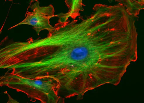 A fluorescence micrograph on a black background showing several irregularly shaped cells. Each cell has a bright blue circular nucleus at its center, a network of green filaments radiating outward through the cell body, and a red-stained outer region with a bright red rim at the cell's edge.