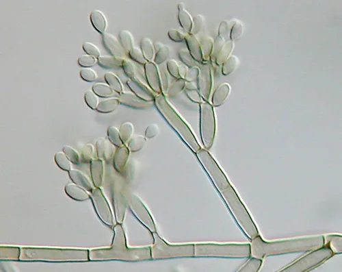 A grayscale DIC micrograph of branching, segmented fungal filaments. Each filament is divided into rectangular cells with thick, bright edges, and the branches end in clusters of oval spores. Cells nearer the viewer appear brighter and more three-dimensional than cells further back, so depth is distinguishable throughout the image.