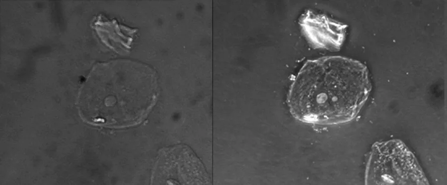 Two side-by-side grayscale micrographs of the same field of cells on a gray background. In the left (brightfield) image, the cells are faint, nearly invisible outlines with a small darker circle in the center. In the right (phase-contrast) image, the same cells appear as bright, high-contrast outlines with a bright circle in the center, standing out clearly against the background.