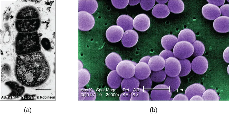 Two panels. (a) A grayscale TEM micrograph on a clear background showing a dark, oval cell outlined by a double membrane line, with web-like internal structures visible inside. (b) A color-enhanced SEM micrograph showing large, three-dimensional purple clusters of cells against a green background dotted with small holes.