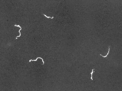 A darkfield micrograph on a black background showing several thin, bright white spiral filaments scattered across the frame.