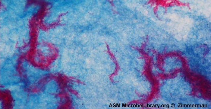 A micrograph of red, thread-like curved bacterial chains scattered across a blue-stained background.